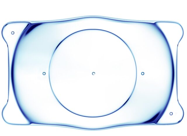 眼内コンタクトレンズの安全性