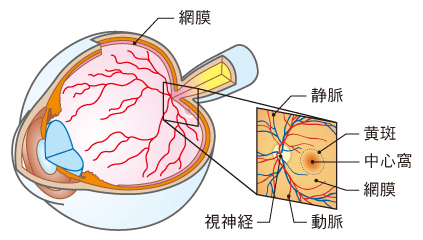 加齢黄斑変性①