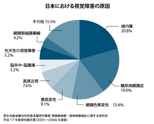 加齢黄斑変性②