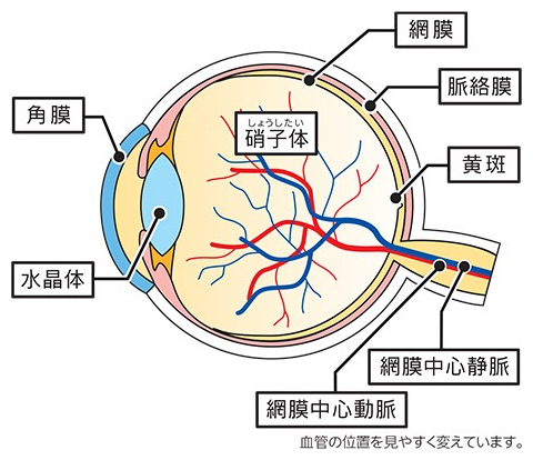 網膜静脈閉塞症