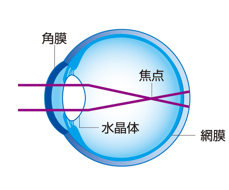 つける前…近視の状態